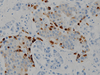 Chromogranin A - 760-2519 - Ventana Medical Systems, Inc.