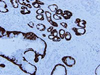 CONFIRM Cytokeratin - 790-4373 - Ventana Medical Systems, Inc.