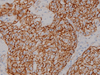 Beta-catenin - 760-4242 - Ventana Medical Systems, Inc.