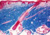 Gomori`s One Step Trichrome Method for Connective Tissue - k017 - Poly Scientific