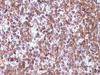 CD25 - 760-4439 - Ventana Medical Systems, Inc.