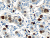 CONFIRM Topoisomerase IIa - 790-4371 - Ventana Medical Systems, Inc.