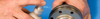 Excel Surface Prep Materials -- Vibra-Tite® - Image
