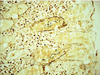 Steiner Staining Kit - 860-018 - Ventana Medical Systems, Inc.