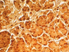 Grimelius Silver Method for Argyrophil Cells - k021 - Poly Scientific