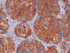 Calcitonin - 760-2611 - Ventana Medical Systems, Inc.