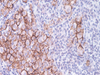 Melanoma Associated Antigen - 760-4527 - Ventana Medical Systems, Inc.