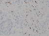 HHV-8 (Human Herpes Virus Type 8) - 760-4260 - Ventana Medical Systems, Inc.