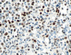 c-Myc - 790-4628 - Ventana Medical Systems, Inc.