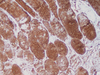 Myoglobin - 760-2660 - Ventana Medical Systems, Inc.
