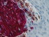 CONFIRM Tyrosinase - 790-4365 - Ventana Medical Systems, Inc.