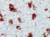 Alpha-1-Antichymotrypsin (ACT) - 760-2604 - Ventana Medical Systems, Inc.