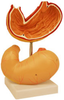 Stomach Model - B10421 - Parco Scientific Company
