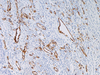 CD31 - 760-4378 - Ventana Medical Systems, Inc.
