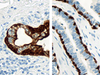Basal Cell Cocktail - 790-4536, 790-1010 - Ventana Medical Systems, Inc.