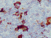Alpha-1-Antitrypsin (AAT) - 760-2605 - Ventana Medical Systems, Inc.