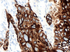 Cytokeratin 5/6 - 790-4554 - Ventana Medical Systems, Inc.
