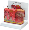Skin Burn Model - B3800 - Parco Scientific Company