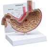 Stomach with Ulcers Model - B2000 - Parco Scientific Company