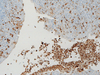 Lysozyme - 760-2656 - Ventana Medical Systems, Inc.