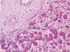 PAS Staining Kit - 860-014 - Ventana Medical Systems, Inc.