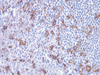 CD14 - 760-4523 - Ventana Medical Systems, Inc.