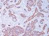 Calponin-1 - 760-4376 - Ventana Medical Systems, Inc.
