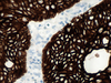 Cytokeratin (CAM 5.2) - 790-4555 - Ventana Medical Systems, Inc.
