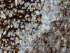 CONFIRM CD23 - 790-4408 - Ventana Medical Systems, Inc.