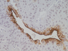 Uroplakin III - 760-4533 - Ventana Medical Systems, Inc.