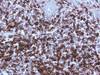 CONFIRM CD45RO - 790-2930 - Ventana Medical Systems, Inc.