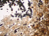 Dieterle Method for Spirochetes & Legionnaires Disease - mw024 - Poly Scientific