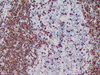 p27kip1 - 760-4268 - Ventana Medical Systems, Inc.