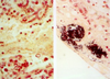 Brown Hopps Method For Gram Positive & Negative Bacteria - k005 - Poly Scientific