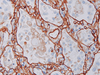 Collagen Type IV - 760-2632 - Ventana Medical Systems, Inc.
