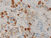 Prolactin - 760-2803 - Ventana Medical Systems, Inc.