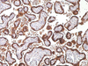 Human Chorionic Gonadotropin (hCG) - 760-2650 - Ventana Medical Systems, Inc.