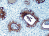 Thyroglobulin - 760-2671 - Ventana Medical Systems, Inc.