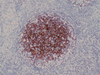 CD21 - 760-4245 - Ventana Medical Systems, Inc.