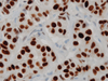 CONFIRM Estrogen Receptor (ER) - 790-4324, 790-4325 - Ventana Medical Systems, Inc.