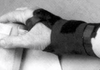 Wrist Supports -  - DME Company