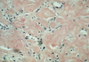 Alkaline Congo Red Method for Amyloid - k091 - Poly Scientific