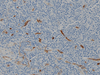 CONFIRM CD34 - 790-2927 - Ventana Medical Systems, Inc.