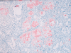 Congo Red Staining Kit - 860-026 - Ventana Medical Systems, Inc.