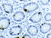Gastrin - 760-2643 - Ventana Medical Systems, Inc.