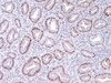 p21WAF1 - 760-4453 - Ventana Medical Systems, Inc.