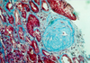 Masson`s Trichrome Method for Connective Tissue - k037 - Poly Scientific