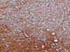GFAP (Glial Fibrillary Acidic Protein) - 760-4345 - Ventana Medical Systems, Inc.