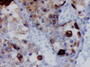FSH (Follicle Stimulating Hormone) - 760-2710 - Ventana Medical Systems, Inc.