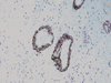 Myosin, Smooth Muscle - 760-2704 - Ventana Medical Systems, Inc.